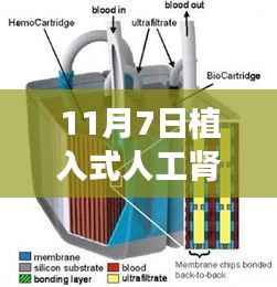 革命性突破!11月7日全新植入式人工肾重塑未来生活科技动态揭秘!