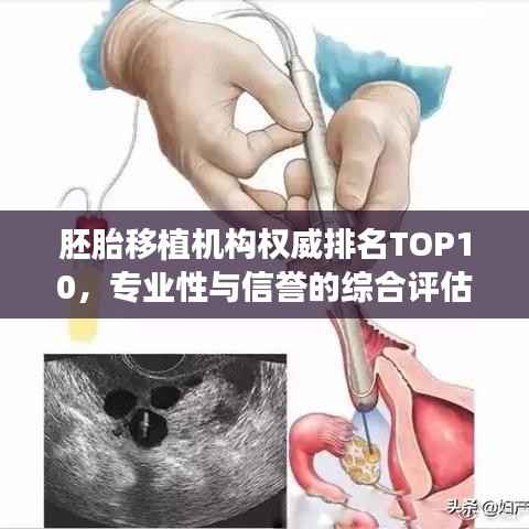 胚胎移植机构权威排名TOP10,专业性与信誉的综合评估榜单